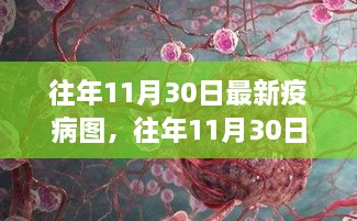 全球最新疫病图谱分析与解读，历年11月30日疫情动态概览