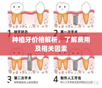 种植牙价格解析，了解费用及相关因素