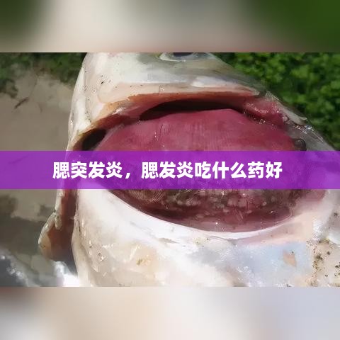 腮突发炎，腮发炎吃什么药好 