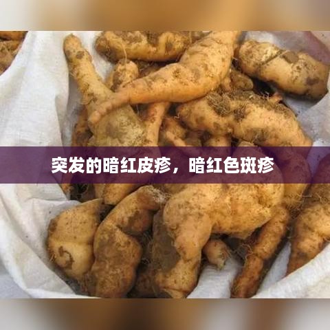 突发的暗红皮疹，暗红色斑疹 