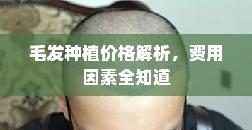 毛发种植价格解析，费用因素全知道